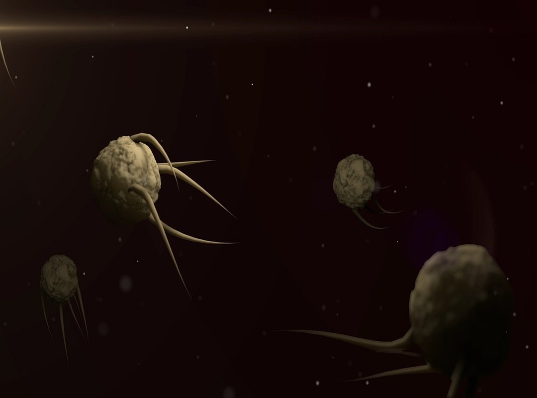 Symptoms and Diagnosis